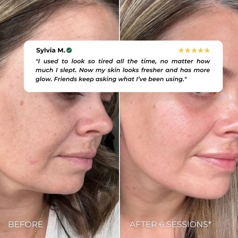 Nuvio EMS Eye Lift Patch