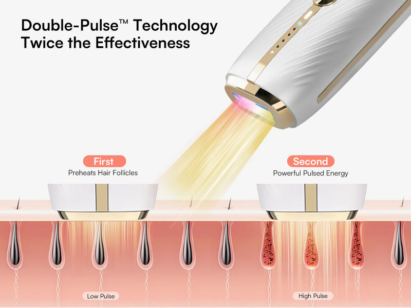 Nuvio IPL Hair Removal Device