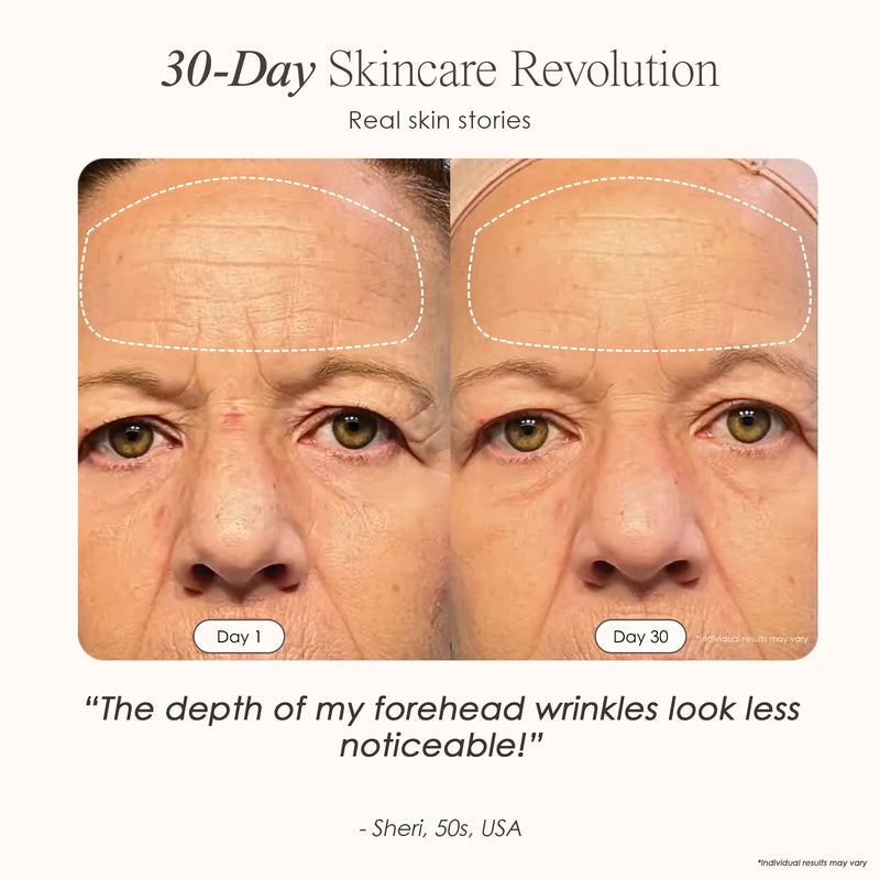 Nuvio 6-in-1 Anti-Aging Wand