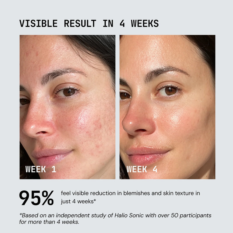 Nuvio UltraLight LED Mask